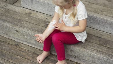 صورة علاج حساسية الجلد والهرش للأطفال