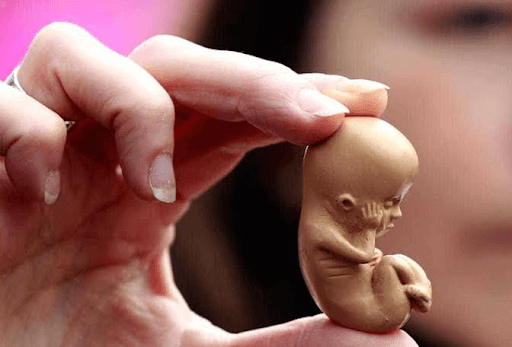 صورة هل حقن لوتوفلون تسبب الإجهاض؟